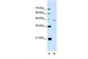 Image no. 1 for anti-Flap Structure-Specific Endonuclease 1 (FEN1) (AA 301-350) antibody (ABIN321044) (FEN1 anticorps  (AA 301-350))