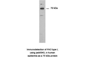 Image no. 1 for anti-Peptidyl Arginine Deiminase, Type I (PADI1) antibody (ABIN346990) (PADI1 anticorps)