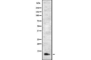 Western blot analysis of DIRC1 expression in HEK293 cells ,The lane on the left is treated with the antigen-specific peptide.