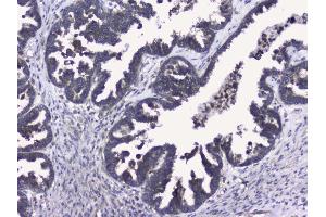 IHC analysis of RALBP1 using anti-RALBP1 antibody (ABIN5692936). (RALBP1 anticorps  (AA 239-506))