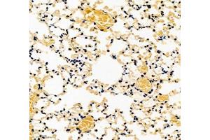 Immunohistochemistry of paraffin embedded mouse lung using COLEC12 (ABIN7073552) at dilution of 1:700 (300x lens)