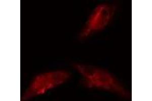 ABIN6278585 staining  293 cells by IF/ICC. (KIF20A anticorps  (C-Term))