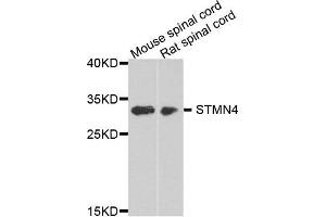Western blot analysis of extract of mouse spinal cord and rat spinal cord cells, using STMN4 antibody. (STMN4 anticorps)