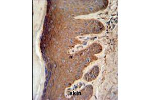PKM2 Antibody (C-term L398) IHC analysis in formalin fixed and paraffin embedded skin tissue followed by peroxidase conjugation of the secondary antibody and DAB staining. (PKM2 anticorps  (C-Term))