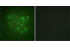Immunofluorescence analysis of A549 cells, using KIF2C (Ab-95) Antibody.