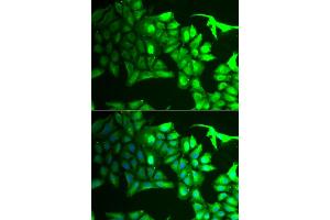 Immunofluorescence analysis of HeLa cells using AIPL1 antibody (ABIN5973857).