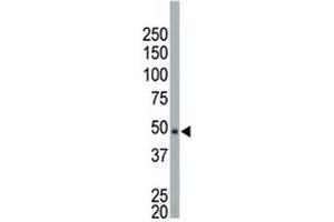 NEK2 antibody used in western blot to detect NEK2 in HeLa cell lysate