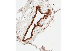 Immunohistochemical analysis of paraffin-embedded Human breast tissue using D performed on the Leica® BOND RXm.