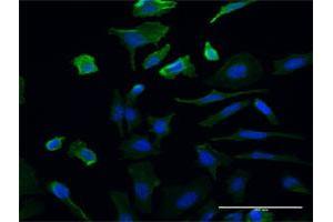 Immunofluorescence of monoclonal antibody to UMPS on HeLa cell. (UMPS anticorps  (AA 381-479))