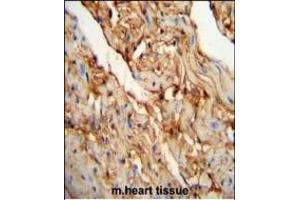 MYOZ1 Antibody (Center) (ABIN651441 and ABIN2840243) immunohistochemistry analysis in formalin fixed and paraffin embedded mouse heart tissue followed by peroxidase conjugation of the secondary antibody and DAB staining. (Myozenin 1 anticorps  (AA 40-69))