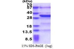 SDS-PAGE (SDS) image for BTB (POZ) Domain-Containing Protein KCTD4 (KCTD4) (AA 1-259) protein (His tag) (ABIN6387327)
