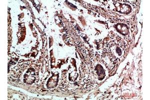 Immunohistochemical analysis of paraffin-embedded human-colon, antibody was diluted at 1:200 (CYFIP2 anticorps  (AA 1171-1220))