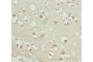 Immunohistochemistry of paraffin-embedded human brain tissue using ABIN7154698 at dilution of 1:100 (GNAO1 anticorps  (AA 60-180))
