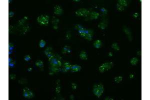 Image no. 10 for anti-Amyloid beta (A4) Precursor Protein (APP) antibody (ABIN1496877) (APP anticorps)