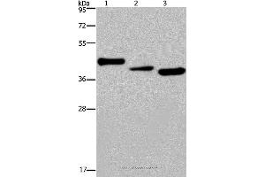 Western blot analysis of Mouse heart tissue, A549 and HepG2 cell, using CYR61 Polyclonal Antibody at dilution of 1:300 (CYR61 anticorps)