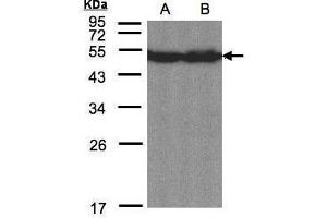 WB Image Sample(30 μg of whole cell lysate) A:Hep G2, B:MOLT4 , 12% SDS PAGE antibody diluted at 1:1500 (CREB3L1 anticorps  (C-Term))