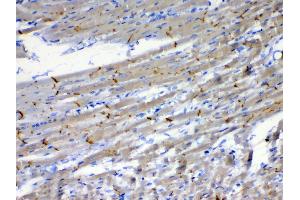 IHC analysis of beta Catenin using anti-beta Catenin antibody .