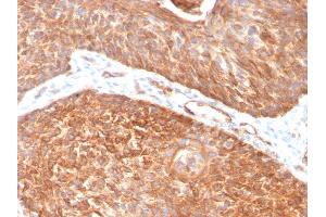 Formalin-fixed, paraffin-embedded human Pancreas stained with Cytokeratin 5 Mouse Monoclonal Antibody (KRT5/3594).