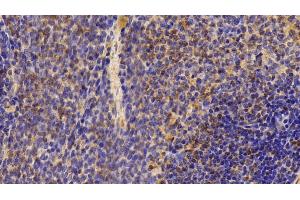 Detection of C3a in Rat Spleen Tissue using Polyclonal Antibody to Complement Component 3a (C3a)
