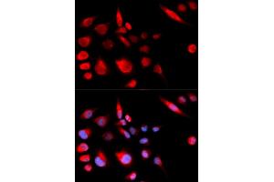 Immunofluorescence (IF) image for anti-Kinesin Family Member 2C (KIF2C) antibody (ABIN1876637) (KIF2C anticorps)