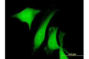 Immunofluorescence of purified MaxPab antibody to CALU on HeLa cell.