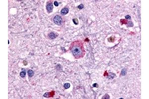 Immunohistochemical staining of Brain (Neurons and glia) using anti- GRM1 antibody ABIN122309