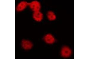 ABIN6275731 staining Hela by IF/ICC. (NKX2-8 anticorps  (N-Term))