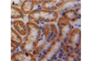 Used in DAB staining on fromalin fixed paraffin-embedded Kidney tissue (PDGF-AA Homodimer (AA 90-190) anticorps)