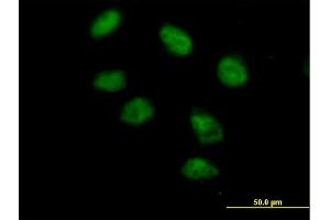Immunofluorescence of purified MaxPab antibody to PAXIP1 on HeLa cell.