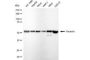 Western blotting analysis using vimentin antibody (ABIN7800840).