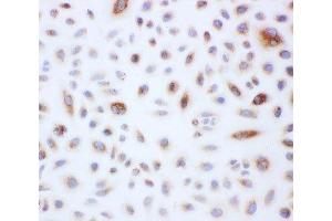Peroxiredoxin 3 antibody and A549 cells tested by ICC