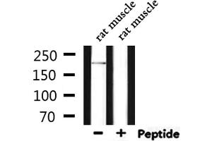 Western blot analysis of extracts from rat muscle, using DOCK7 Antibody. (DOCK7 anticorps  (N-Term))