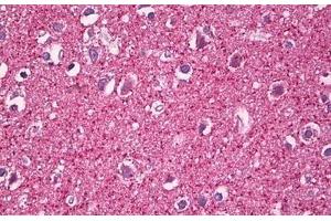 Anti-MZF1 antibody IHC staining of human brain, cortex neuropil. (MZF1 anticorps  (AA 1-50))