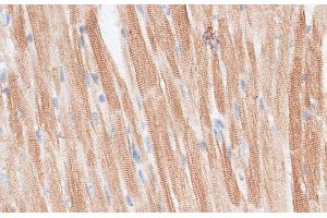 Immunohistochemistry of paraffin-embedded Mouse heart using GRK5 Polyclonal Antibody at dilution of 1:100 (40x lens).