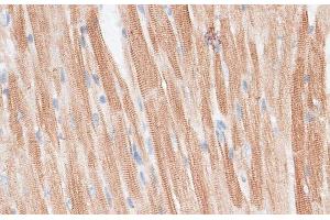 Immunohistochemistry of paraffin-embedded Mouse heart using GRK5 Polyclonal Antibody at dilution of 1:100 (40x lens). (GRK5 anticorps)