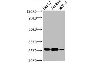 Western Blot  Positive WB detected in:HepG2 whole cell lysate,Jurkat whole cell lysate,MCF-7 whole cell lysate  All lanes:BCL2 antibody at 1μg/ml  Secondary  Goat polyclonal to rabbit IgG at 1/50000 dilution  Predicted band size: 26 KDa  Observed band size: 26 KDa (Recombinant Bcl-2 anticorps)