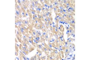 Immunohistochemistry of paraffin-embedded mouse heart using CREB3 antibody (ABIN6291021) at dilution of 1:100 (40x lens).