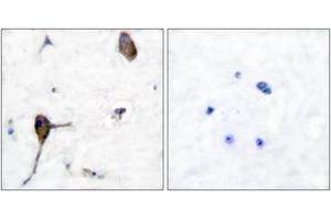 Immunohistochemistry analysis of paraffin-embedded human brain tissue, using IL-3R beta (Ab-593) Antibody.