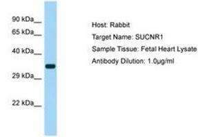 Image no. 1 for anti-Succinate Receptor 1 (SUCNR1) (AA 161-210) antibody (ABIN6750142) (SUCNR1 anticorps  (AA 161-210))