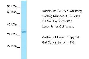 Western Blotting (WB) image for anti-CTD (Carboxy-terminal Domain, RNA Polymerase II, Polypeptide A) Small Phosphatase 1 (CTDSP1) (N-Term) antibody (ABIN2774415)