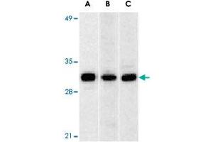Western blot analysis of ANP32A expression in human Raji cell (A), mouse (B) and rat (C) testis tissue llysates with ANP32A polyclonal antibody  at 1 ug/mL . (PHAP1 anticorps  (C-Term))