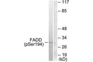 Western blot analysis of extracts from HeLa cells treated with Paclitaxel 1uM 60', using FADD (Phospho-Ser194) Antibody. (FADD anticorps  (pSer194))