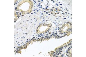 Immunohistochemistry of paraffin-embedded human prostate using STXBP2 antibody (ABIN5975753) at dilution of 1/100 (40x lens). (STXBP2 anticorps)