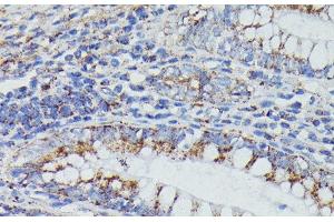 Immunohistochemistry of paraffin-embedded Human colon using NDUFAB1 Polyclonal Antibody at dilution of 1:100 (40x lens). (NDUFAB1 anticorps)