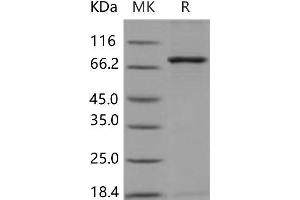 Western Blotting (WB) image for NIMA related kinase 3 (NEK3) (Active) protein (GST tag,His tag) (ABIN7320002)