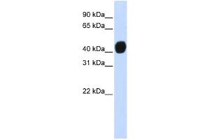 WB Suggested Anti-TGFB1I1 Antibody Titration:  0. (TGFB1I1 anticorps  (N-Term))