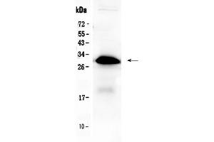 Western blot analysis of IGFBP1 using anti-IGFBP1 antibody . (IGFBPI anticorps  (AA 69-259))