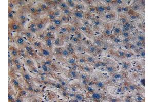 IHC-P analysis of Human Liver Tissue, with DAB staining. (Sonic Hedgehog anticorps  (AA 36-193))