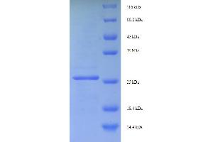 SDS-PAGE (SDS) image for Eukaryotic Translation Initiation Factor 4E Binding Protein 3 (EIF4EBP3) (AA 1-100), (full length) protein (His-SUMO Tag) (ABIN5709457)