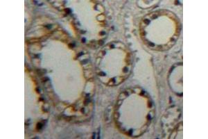 IHC-P analysis of Kidney tissue, with DAB staining. (PTPRB anticorps  (AA 1655-1918))